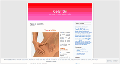 Desktop Screenshot of lacelulitis.wordpress.com