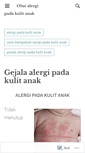 Mobile Screenshot of obatalergipadakulitanak.wordpress.com