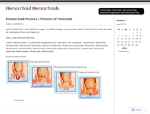 Tablet Screenshot of hemorrhoidhemorrhoids.wordpress.com